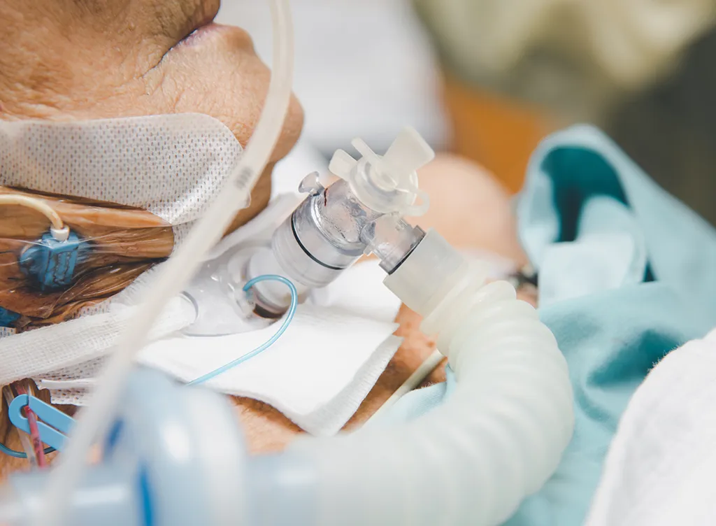 Patient-tracheostomy Intensivpflegerische Versorgung eines beatmeten Patienten mit Trachealkanüle